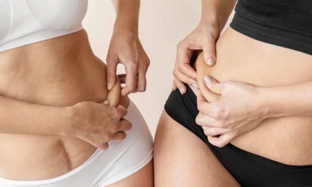 Czy Mężczyznom Faktycznie Przeszkadzają Rozstępy Na Ciele?